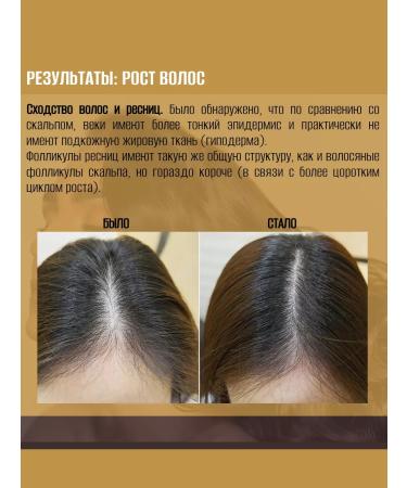 Olfactorius Manufactory SPLENDOUR hair growth activator (capxil gravex) (250g) - Buy Online on GoSupps.com