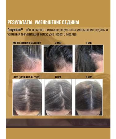 Olfactorius Manufactory SPLENDOUR hair growth activator (capxil gravex) (250g) - Buy Online on GoSupps.com