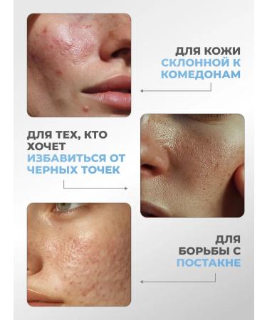 Lefami Serum with niacinamide from acne and acne - Buy Online on GoSupps.com