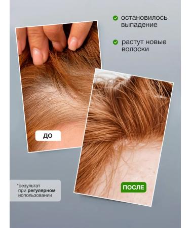 Tashe Shampoo for growth and strengthening hair - Buy Online on GoSupps.com