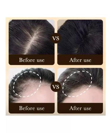 Zozu Anti-hair loss roller serum - Buy Online on GoSupps.com