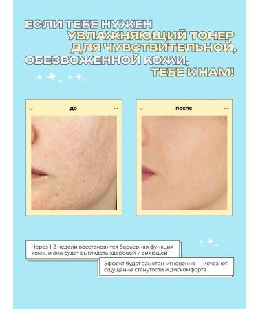 mamaBINU Korea's face toner moisturizer for dry skin - Buy Online on GoSupps.com