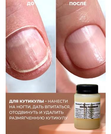 Sofid Face cream from edema and bags under the eyes of a moisturizing - Buy Online on GoSupps.com