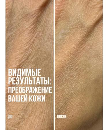 SKINIMALIST Face cream with retinol and niacinamide regenerating - Buy Online on GoSupps.com