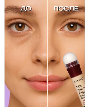 Present for you Classler from dark face circles with pink subton - Buy Online on GoSupps.com