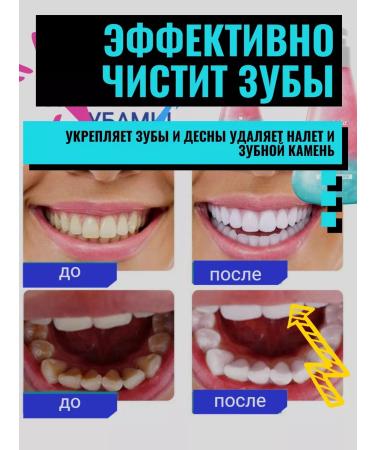 KOREA ORIGINAL Toothpaste whitening with a 220 ml dispenser - Buy Online on GoSupps.com