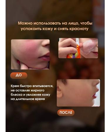 Olesya Mustaeva's Workshop Cream for diapers children "Kalyabushki" - Buy Online on GoSupps.com