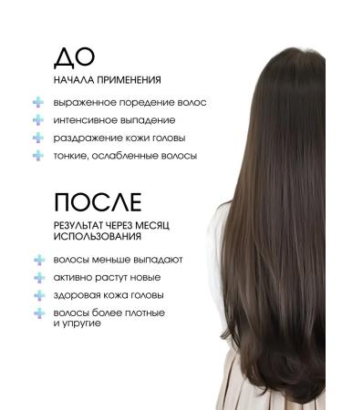 Sim Sensitive System 4 shampoo from falling out and for hair growth 500 ml - Buy Online on GoSupps.com