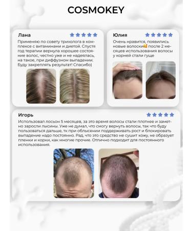 Cosmokey Trikapil 5% serum from hair loss 3 pcs - Buy Online on GoSupps.com