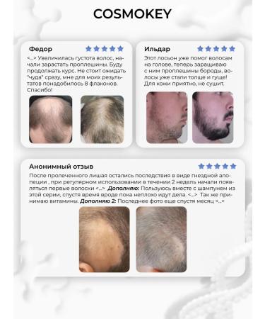 Cosmokey Trikapil 5% serum from hair loss 3 pcs - Buy Online on GoSupps.com