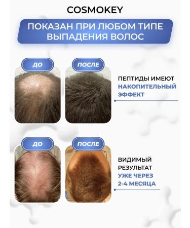 Cosmokey Trikapil 5% serum - Hair growth activator 6 pcs - Buy Online on GoSupps.com