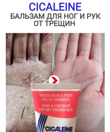 Akileine Balm for the legs and arms from cracks Cicaleine 75ml - Buy Online on GoSupps.com