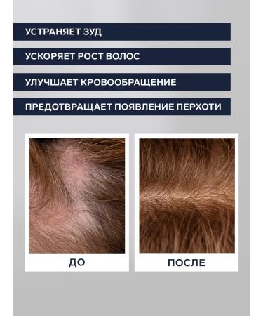 EVSI Hair growth peeling - Buy Online on GoSupps.com