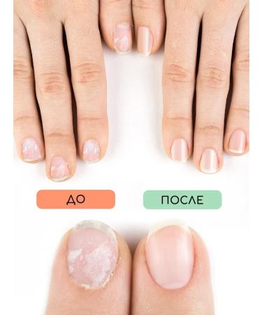 INKI Keratin products set for strengthening and growth of nails - Buy Online on GoSupps.com