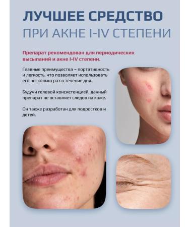 NANO-SILVER GEL Wede-gel for the face and body from acne and acne - Buy Online on GoSupps.com