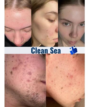 Clean Sea Crust serum for acne and antennas - Buy Online on GoSupps.com