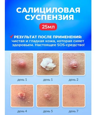 PROPELLER Set for problem skin (gel + salicylic chatterbox) - Buy Online on GoSupps.com