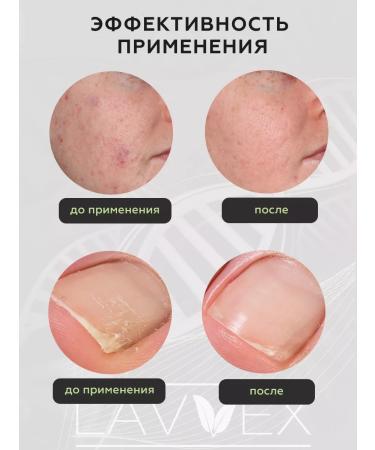 ARKADA LAVVEX ARKADA MC 16 antifungal serum for nail growth - Buy Online on GoSupps.com