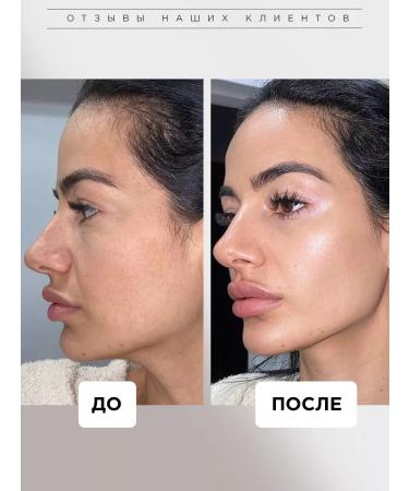 HA LO BEAUTY Korea's face serum - Buy Online on GoSupps.com