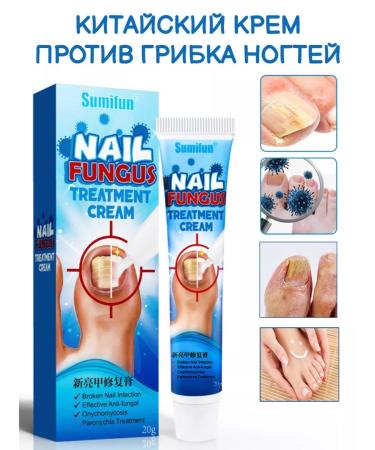 100% Original Anti-nail fungus cream
