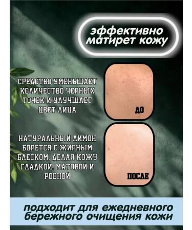 Himalaya Since 1930 Seborrial gel for washing with lemon 150ml - Buy Online on GoSupps.com