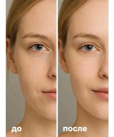 BAZE Moisturizing facial serum - Buy Online on GoSupps.com