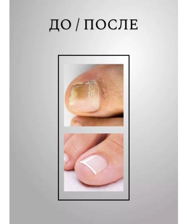 ZenWay Nail fungus remedy - Buy Online on GoSupps.com