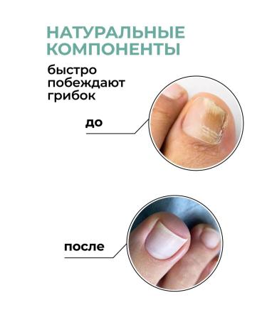 ZENZE Nail fungus agent 30 ml - Buy Online on GoSupps.com