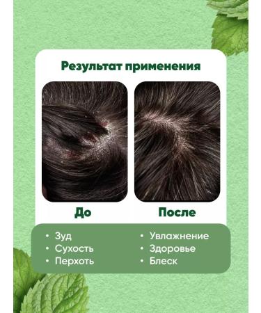 MASIL Deep shampoo cleansing with probiotics 5 Probiotics 50 ml - Buy Online on GoSupps.com