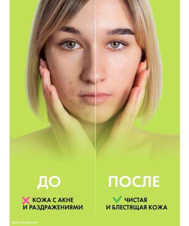 HOLLY POLLY Facial serum from acne salicylic dot 30 ml - Buy Online on GoSupps.com