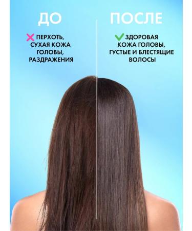 HOLLY POLLY Hair mask from dandruff and seborrhea soothing 100 ml - Buy Online on GoSupps.com