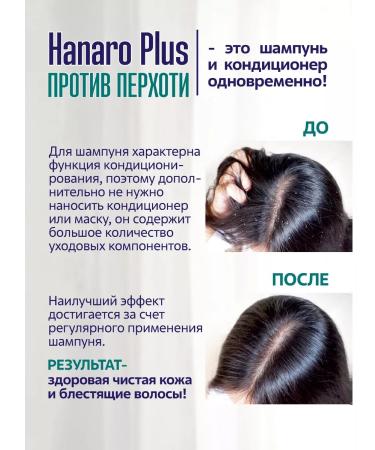 KeraSys Hanaro Plus Shampoo Contractor Against Dandrition 680ml Korea - Buy Online on GoSupps.com