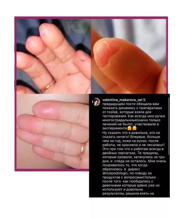 ROSILAK Mask cream for problem and sensitive skin - Buy Online on GoSupps.com