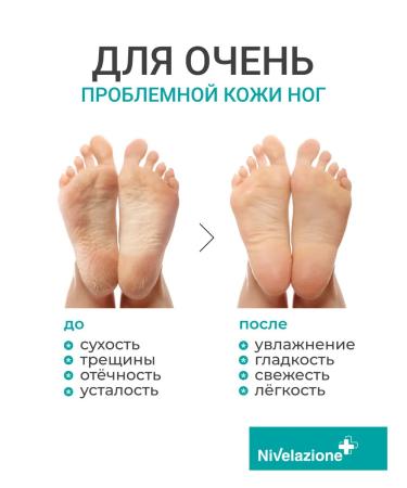 Feet cream with urea from crunches of corns and dryness - Buy Online on GoSupps.com