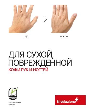 Hand cream with urea moisturizer for dry skin - Buy Online on GoSupps.com