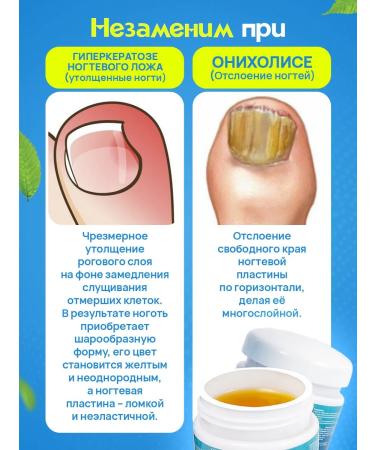 100% Original Chinese remedy for nail fungus - Buy Online on GoSupps.com