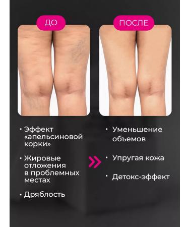 Redox Anti -cellulite cream and scrub set - Buy Online on GoSupps.com