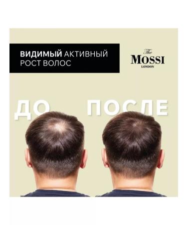 The Mossi London Unique hair growth oil - Buy Online on GoSupps.com