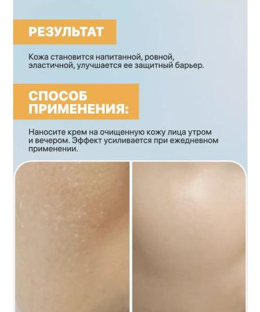 Vitex OIL Facial Cream Food for dry and atopic leather - Buy Online on GoSupps.com