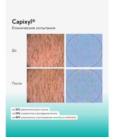 CAREPROST Hair loss serum 100 ml - Buy Online on GoSupps.com