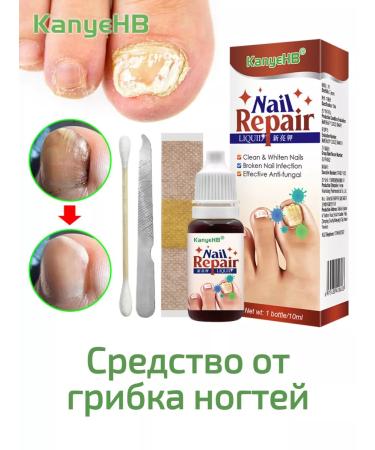 100% Original nail fungus remedy - Buy Online on GoSupps.com