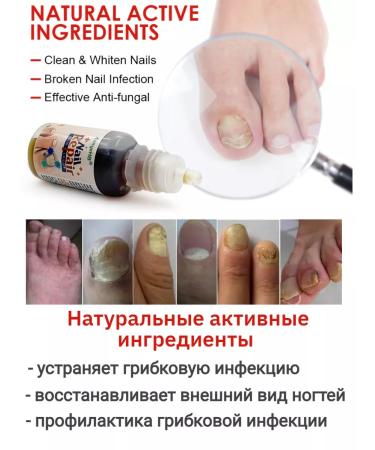 100% Original nail fungus remedy - Buy Online on GoSupps.com