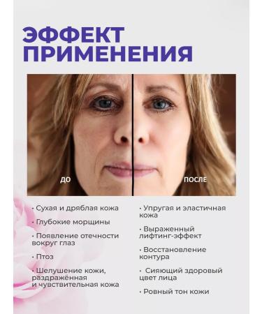 redox Face cream Powerful lifting 150 ml - Buy Online on GoSupps.com