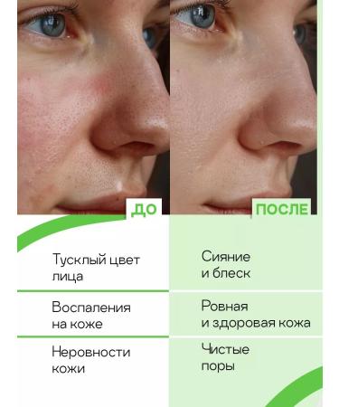 Oh My Face Face washing gel cleansing from acne for oily skin - Buy Online on GoSupps.com