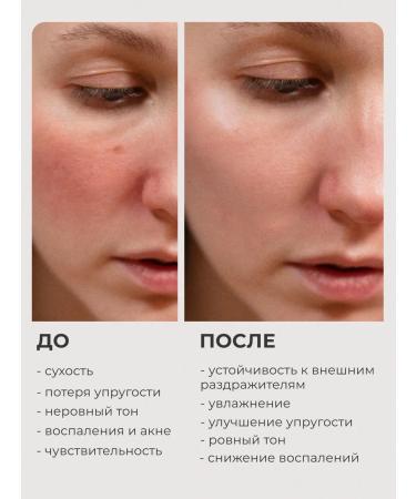 The Right Cosmetics Face serum anti -aging anti -aging from wrinkles - Buy Online on GoSupps.com