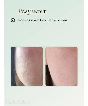 My Geranica Pimpling tonic with a cleansing acidic for problem skin - Buy Online on GoSupps.com