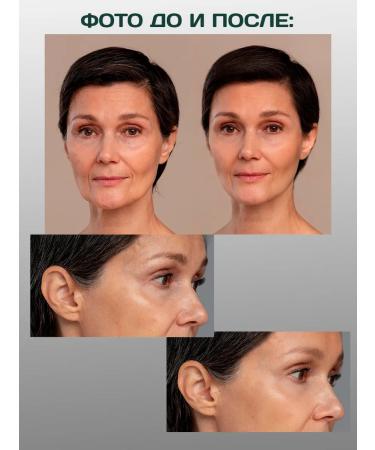 Shiffa Home Biotin 5000 g Vitamins for women T rkiye - Buy Online on GoSupps.com