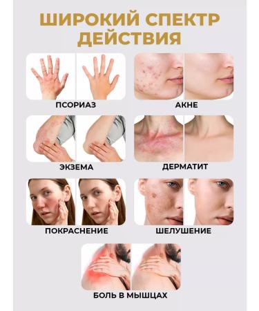 NaftaOne Ointment from psoriasis and acne naphthalan paraffin for hand - Buy Online on GoSupps.com