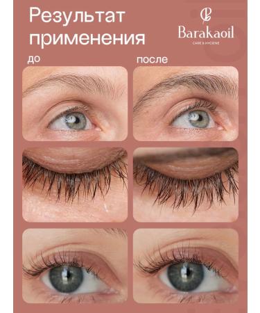 Baraka Oil for the growth of eyebrows and eyelashes 10ml - Buy Online on GoSupps.com