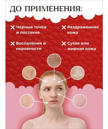 COSRX Penfa for washing from acne - Buy Online on GoSupps.com